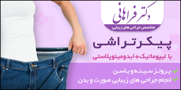 پیکرتراشی با لیپوماتیک و ابدومینوپلاستی – دکتر مهدی فراهانی