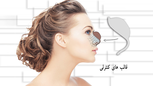 مهندسی جراحی بینی؛ این علم نوین را بشناسید!