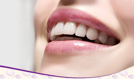 اصلاح طرح لبخند
