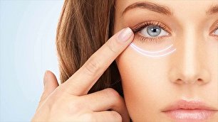 چگونه چروک های چشم را یک شبه از بین ببریم؟