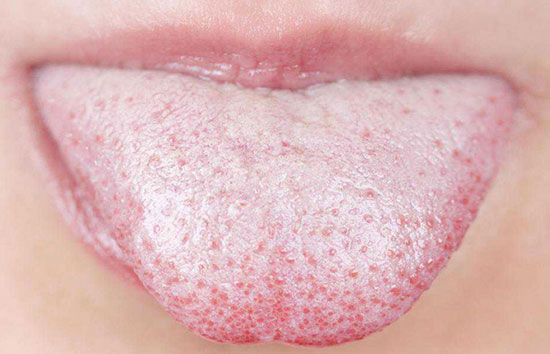 تغییر رنگ زبان نشانه چیست؟