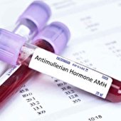 اهمیت تست AMH برای اندازه‌گیری ذخیره تخمدان در درمان ناباروری