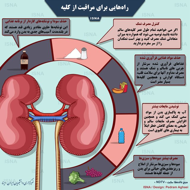 اینفوگرافی / راه‌هایی برای مراقبت از کلیه