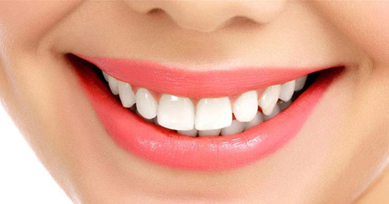جراحی لثه؛ روش‌های آن و قیمت سال ۹۹