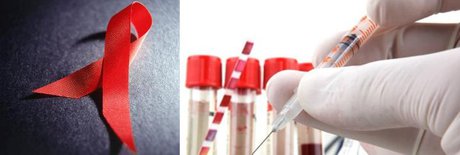 تشخیص دیرهنگام HIV در نیمی از زنان اروپایی