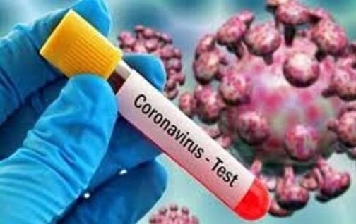 نتیجه تست کرونای سخنگوی دولت هنوز اعلام نشده است