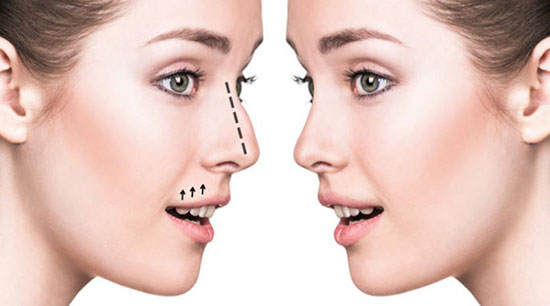جراحی زیبایی بینی- دکتر مهرداد مقیمی