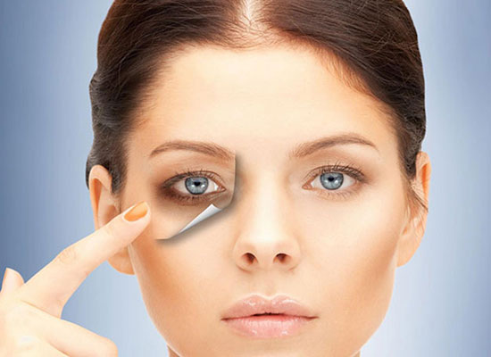 کربوکسی‌تراپی؛ روشی برای رفع سیاهی دور چشم
