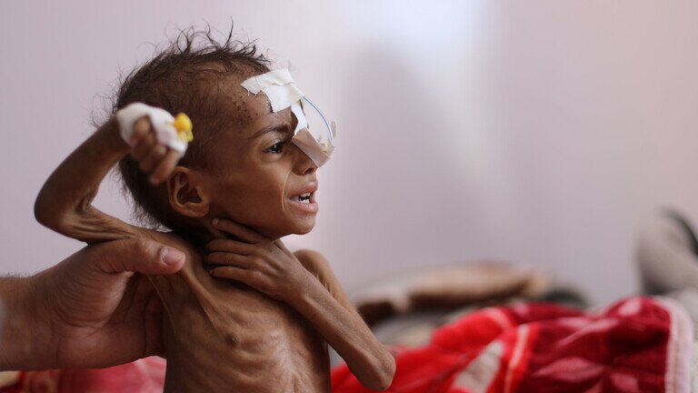 هشدار سازمان ملل نسبت به خطر قحطی در یمن