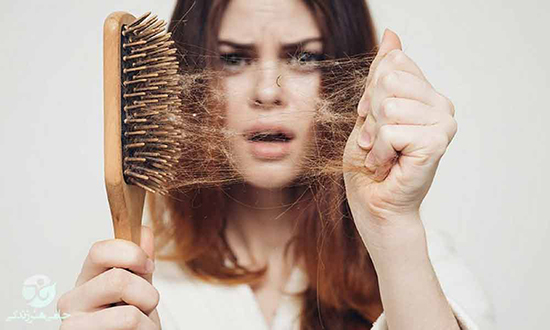 طاسی مردانه؛ همیشه هم ژنتیک مقصر نیست